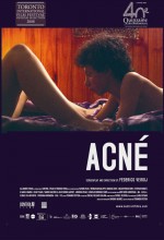 Acne (2007) afişi