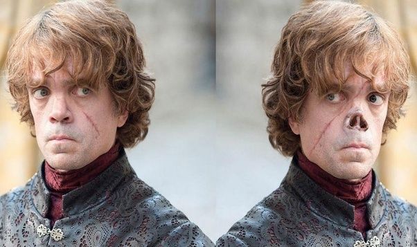 Tyrion aslında burunsuz kalmalıydı!