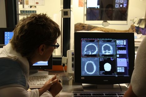 Brainscan Aku Dan Topi Ajaib Fotoğrafı