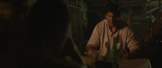 Septic Man Fotoğrafı