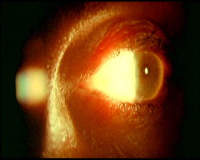 Encarnación Fotoğrafı