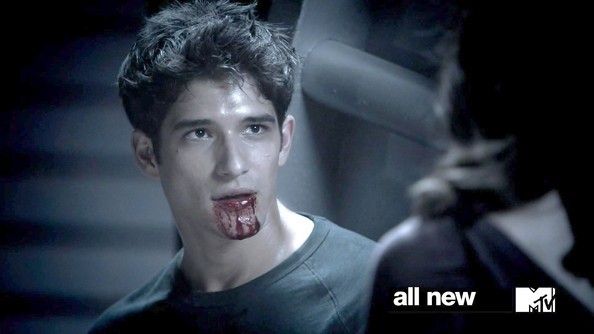 Teen Wolf Fotoğrafı
